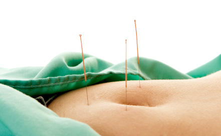 acupuncture femme
