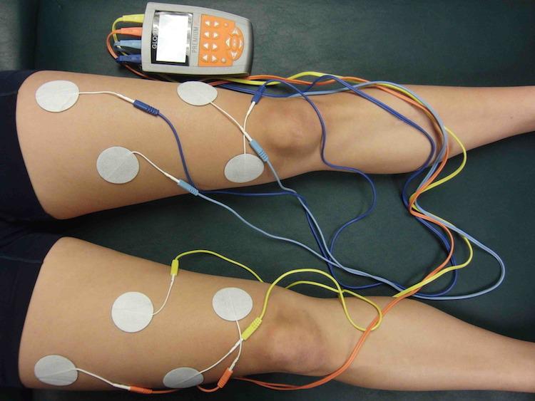 appareil pour electrostimulation